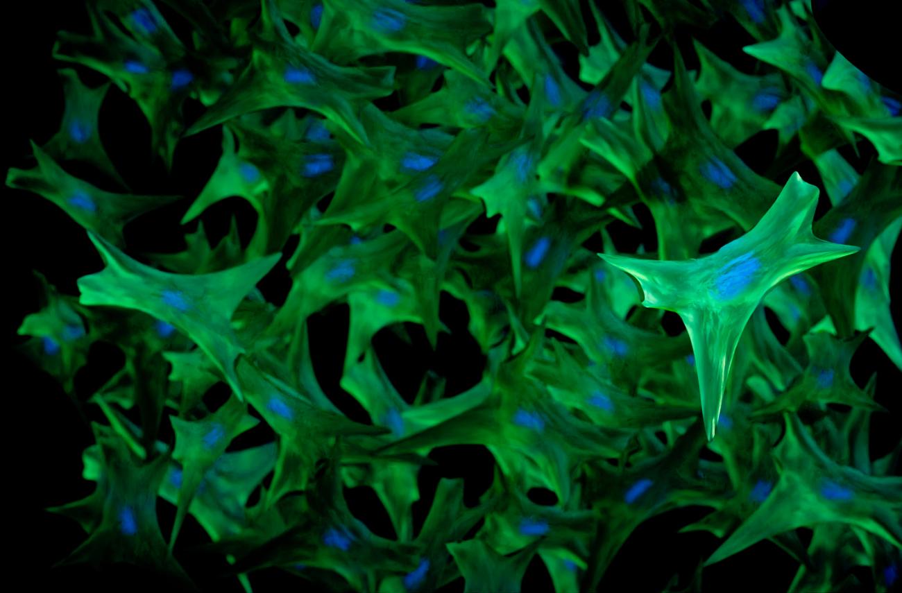 Scientific image showing green, spiky substance lined with bright blue ovals