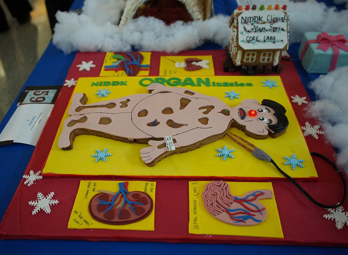 A gingerbread of the operation board game, with cartoon man and light-up red nose, and several organs displayed on the sides