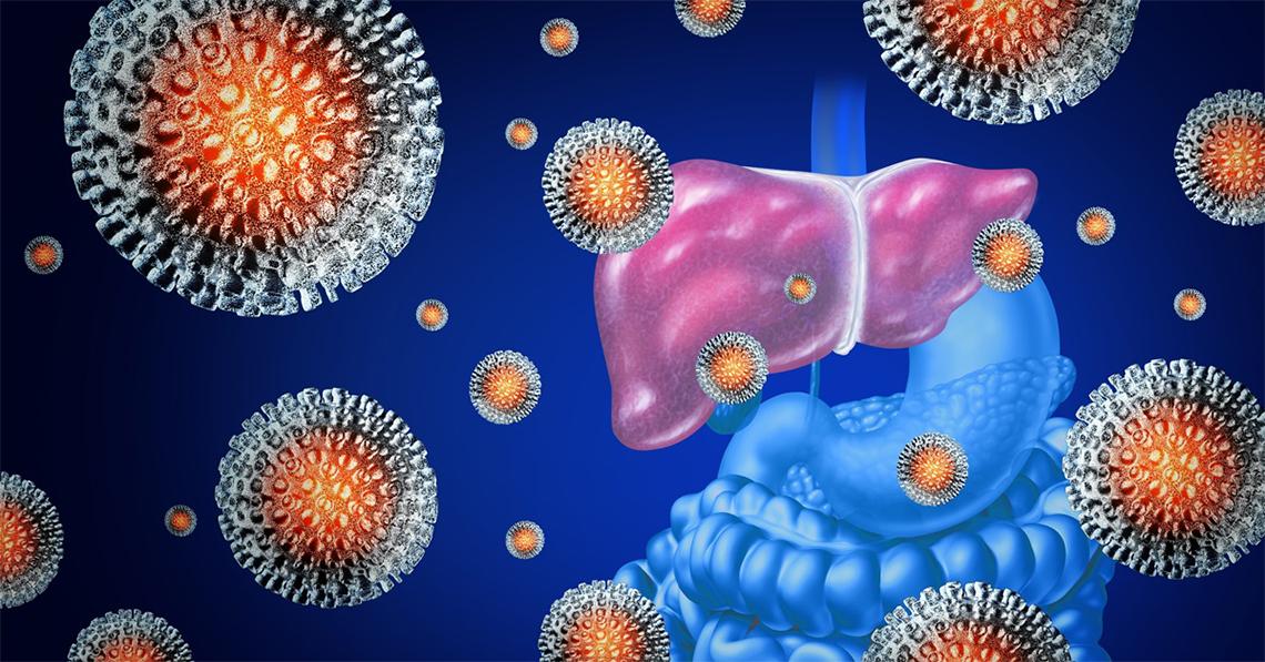 Fda Grants Authorization To First Hepatitis C Test 