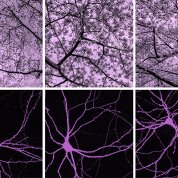 A web of purple neurons on a black background below images of blossoming cherry tree branches against a lavender sky