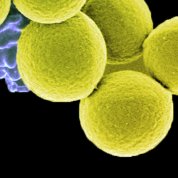 Cells that look like tennis balls