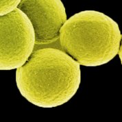 Cells that look like tennis balls
