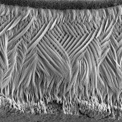 Enamel rods protecting a tooth’s surface