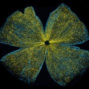 A mouse retina appears as a large, 4-petaled flower of gold glitter against a black backdrop