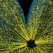A mouse retina appears as a large, 4-petaled flower of gold glitter against a black backdrop