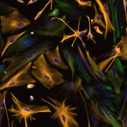 Scientific image of gold starbursts with purple spots on background of dark green and black