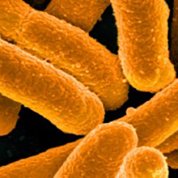 E-coli bacteria appear as wide, yellow rods against black background