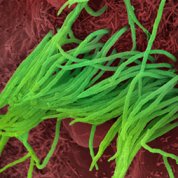 scientific image of green spaghetti-like strands on bed of red