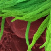 scientific image of green spaghetti-like strands on bed of red
