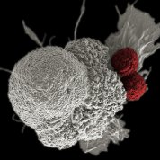 Large, white spongy masses in white of a cancer cell being attacked by 2 red balls representing cytotoxic T cells
