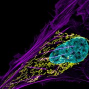 The blue bubble of a cancerous cell surrounded by purple and yellow wisps of cellular parts