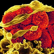 Scientific image of red globes bunched together with yellow ribbon-like substance threading through them