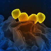 Streptococcus pyrogenese bound to a human neutrophil 