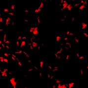 Mixture of normal and sickle-shaped red blood cells on a black background