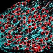 Section of auditory nerve in a young adult mouse