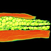 Blood vessel and mitochondria in a mouse heart viewed under microscope