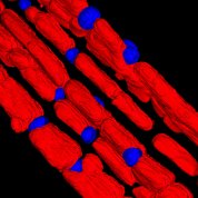 Mitochondria look like red rods with fat droplets that are blue under an electron microscope.