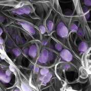 H5N2 avian influenza virus trapped in carbon nanotubes.