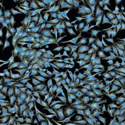 Panoramic view of HeLa cells