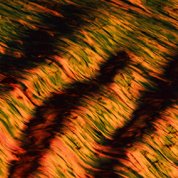 Brown and beige wavy lines of collagen fibers in the knee