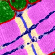 Image of an adult mouse heart cell