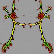Mouse hippocampal neuron stained for f-actin (red) and tubulin (green) look like the devil dancing ballet