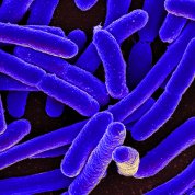 Several purple, cylinder-shaped  E. coli bacteria