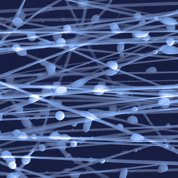 2-6-micrometer-thick microparticles attached to the 1-micrometer-thick microfibers.
