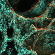 Scientific image of red ribbons threading through oblong green spots