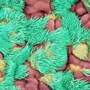 Cilia, looking like clumps of green grass, surround reddish and yellow masses in a mouse's trachea