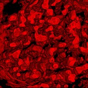 Red splotches representing mitochondrial networks on a black background