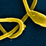 Ebola virus particle