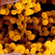 scientific image of coronavirus bubbles and tubes in yellows, browns, pinks