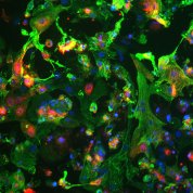 Wisps of green and blue (heart cells) speckled with multicolored dots representing covid