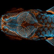 Dorsal view of bones, scales and lymphatic vessels in a juvenile zebrafish