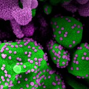 Big fuzzy green circles are covered in small purple particles.