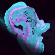 scientific image of blue blob shaped vaguely like Lincoln head's silhouette