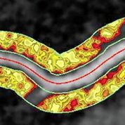 Scientific image of curved yellow tube with a road-like band of gray running horizontally through it. The "road" of gray is bisected by a red line.