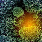 A microscopic view of variant strain of SARS-CoV-2 virus particles