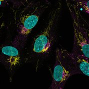 A microscopic image revels La Crosse virus in neural stem cells