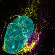 A microscopic image revels La Crosse virus in neural stem cells