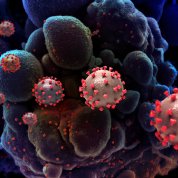 SARS-CoV-2 virus particles