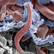 Scanning electron micrograph of a sickled red blood cell (red) inside the circulatory structures of the human spleen, whose function is to filter and remove unhealthy red blood cells, including rigid cells such as sickle-shaped cells. The blue cells indicate the wall of a splenic sinus (small vein where red blood cells are filtered). The gray structures indicate the splenic cords—cellular clusters where the red blood cells are checked by macrophages for the presence of surface alterations or certain antibo