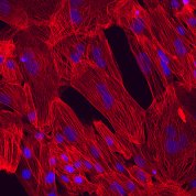 Large chunks of red with blue dots