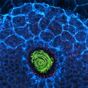 scientific image of green circular swirl surrounded by small red dashes on a blue webbed background  