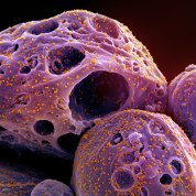 Novel Coronavirus SARS-CoV-2 (Omicron)