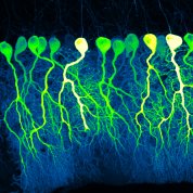 scientific image of brains cells resembling a line of green, yellow, and cream-colored balloons on strings floating in a black background