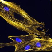 Immunofluorescence image of actin bundles in muscle precursor cells called myoblasts. 