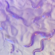 Caenorhabditis elegans under a microscope