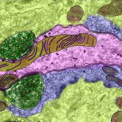 A long pink patch surrounded by purple, then green, with potato-like brown patches